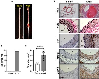 Profiling of Histone Modifications Reveals Epigenomic Dynamics During Abdominal Aortic Aneurysm Formation in Mouse Models